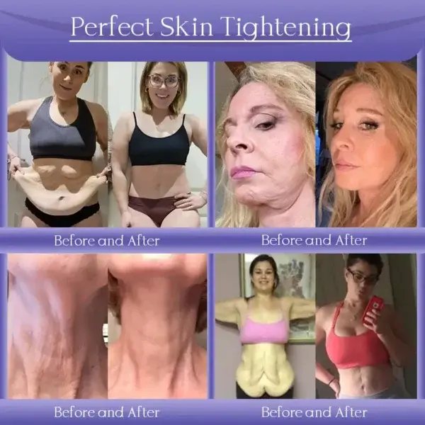 Anti-Wrinkle Skin Cream for Remove Wrinkles