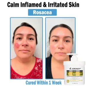 Bee Bright Multi-Symptom Skin Treatment Cream