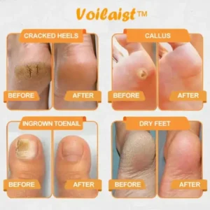 Bee Venom Lymphatic Drainage & Slimming Foot SoakBeads