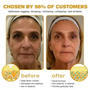 Botox Bee Venom Wrinkle Remover Cream