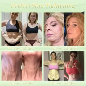 Firming Cream——Visibly Firms in Just 21 Days – Without Surgery or Irritation