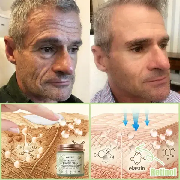 Firming Cream——Visibly Firms in Just 21 Days – Without Surgery or Irritation