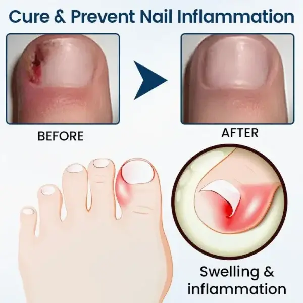 Fungal Repair Herbal Spray
