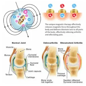 Lymphatic Magnetic Therapy Diamond Ring