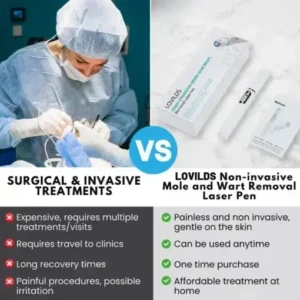Non-Invasive Mole and Wart Removal Laser Pen