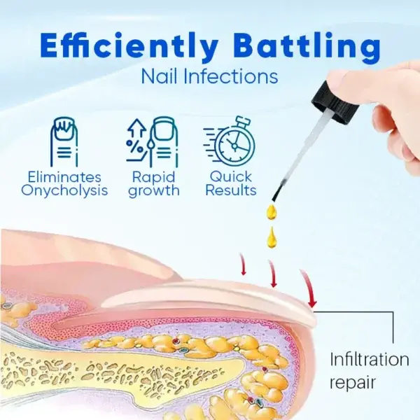 OnyxoGuard Nail Growth and Repair Serum