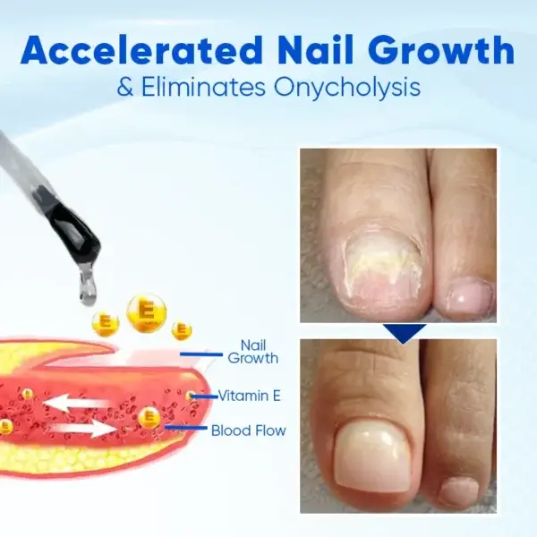 OnyxoGuard Nail Growth and Repair Serum
