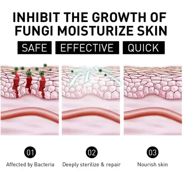 Psoriasis Cure Cream