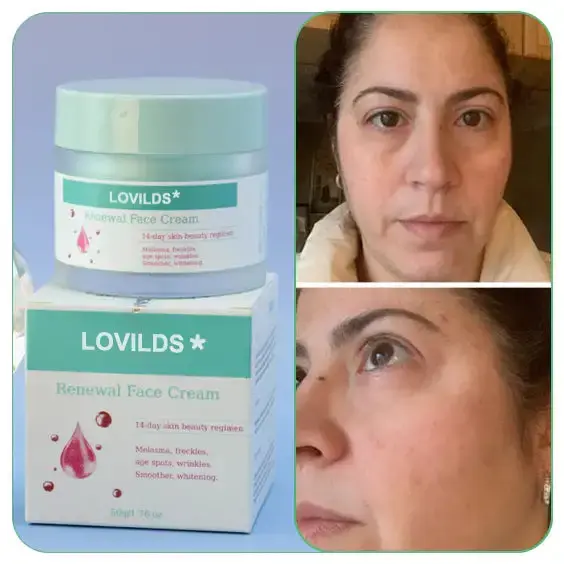 Renewal Skin Cream