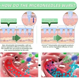 SMGT-GLP-1 Nano Microneedle Patch