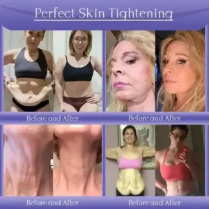 Skin Firming & Anti-Wrinkle Cream