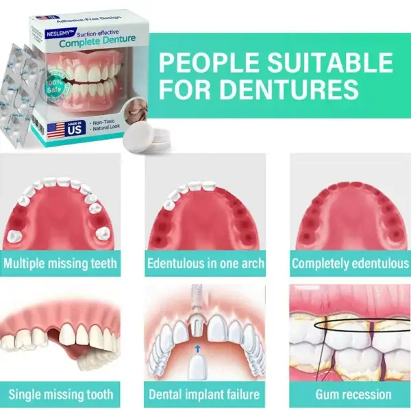 Suction-fit Complete Denture