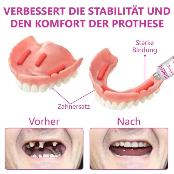 Thermischer Prothesenkleber