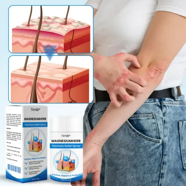 Timilk® MagnesiumHerb Psoriasis Relief Cream