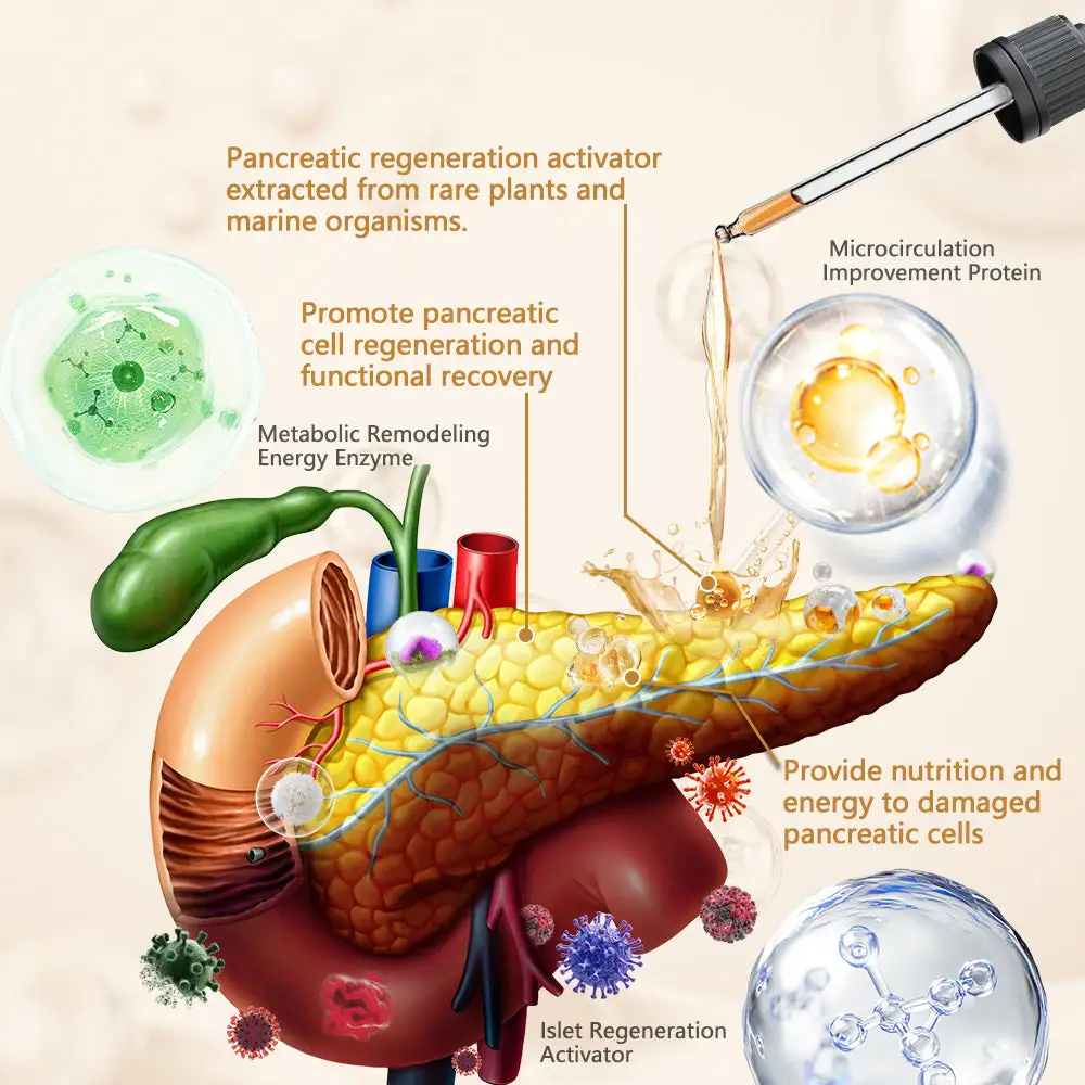 Blood Sugar Treatment Pancreas Supplement Essence - Image 3