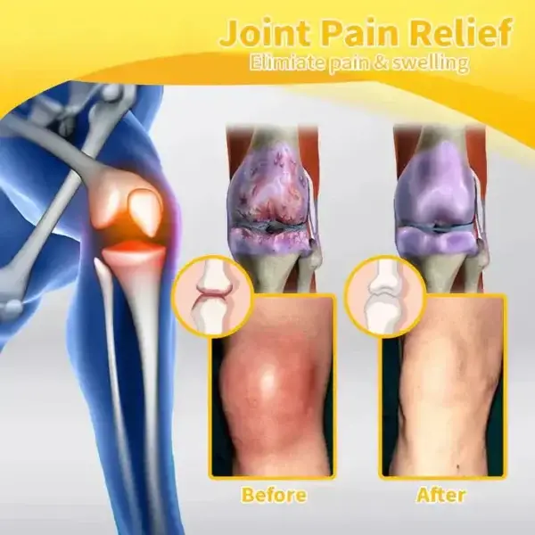 Magnesium Oil & Bee Venom Joint Healing Spray Approved by the American Academy of Orthopaedic Surgeons (AAOS) - Image 9