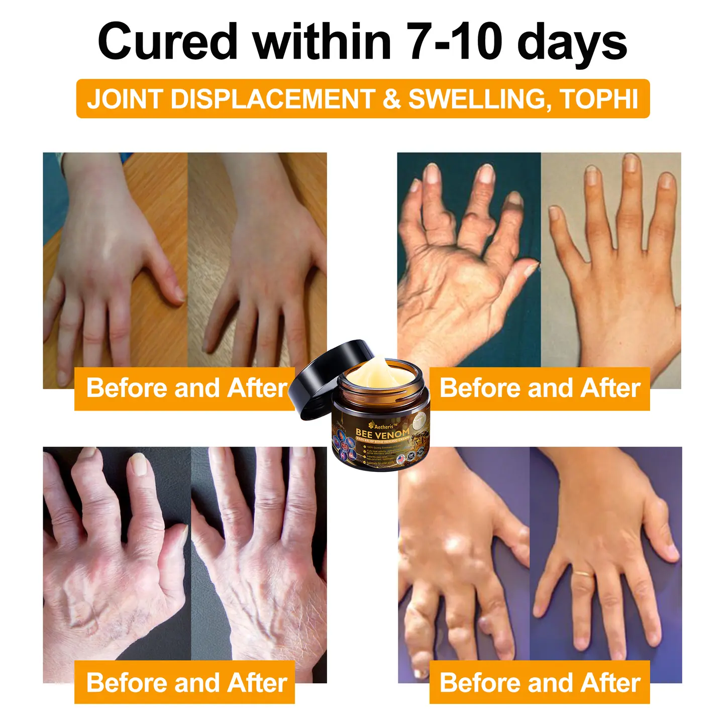 Bee Venom Arthritis Therapy Cream - Image 5