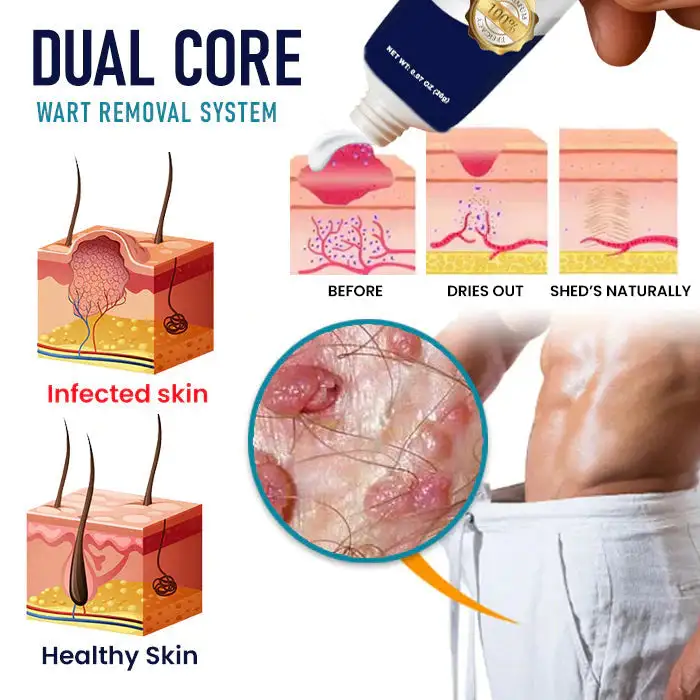 |Genital Warts Remover Cream for Men - Image 15