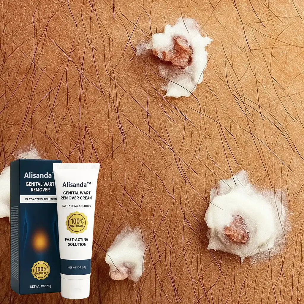 |Genital Warts Remover Cream for Men - Image 22