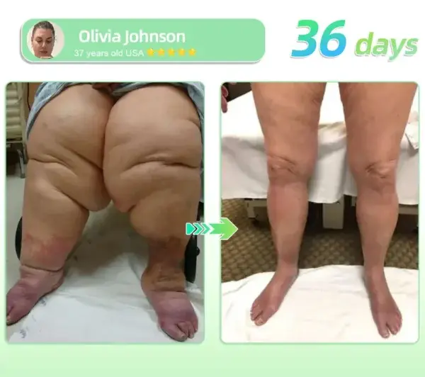 All Natural Support