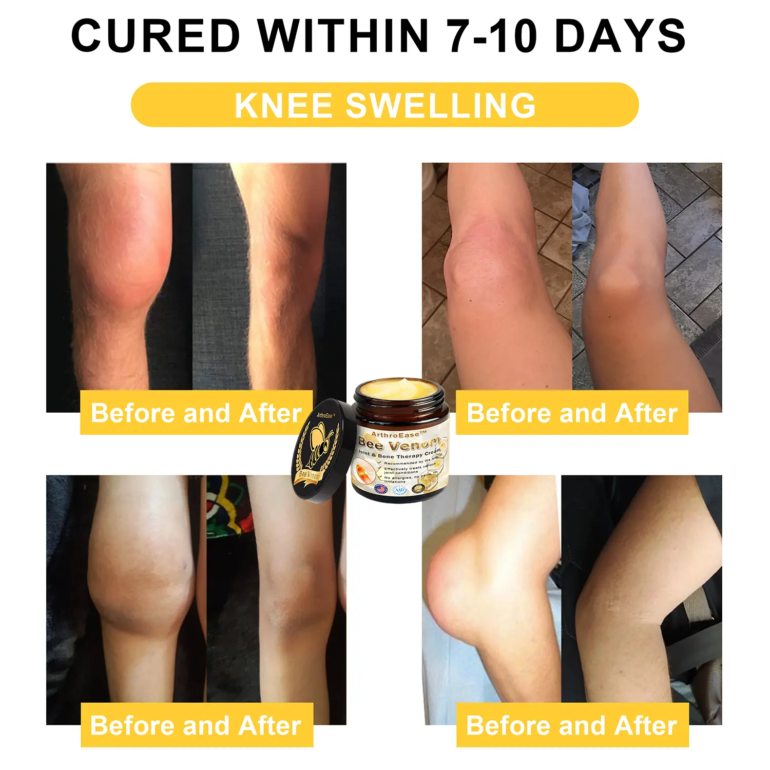 ArthroEase Bee Venom Arthritis Therapy Cream - Image 4