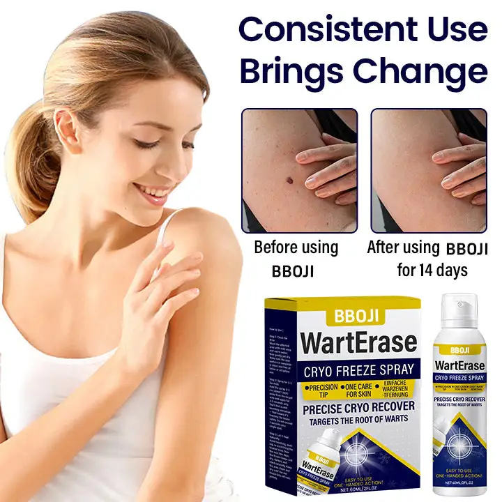 BBOJI WartErase Cryo Freeze Spray - Image 8