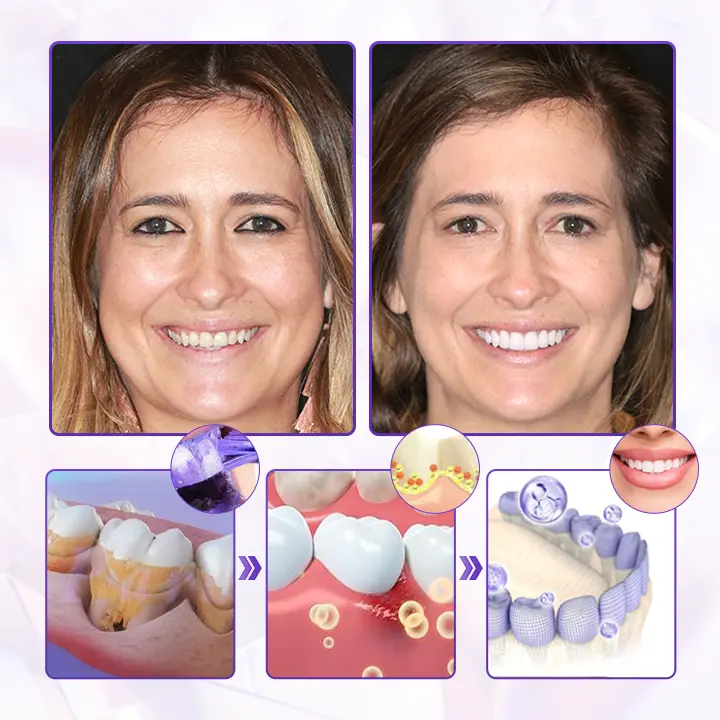 BeeRenew Advanced Gum Healing Toothpaste - Image 3