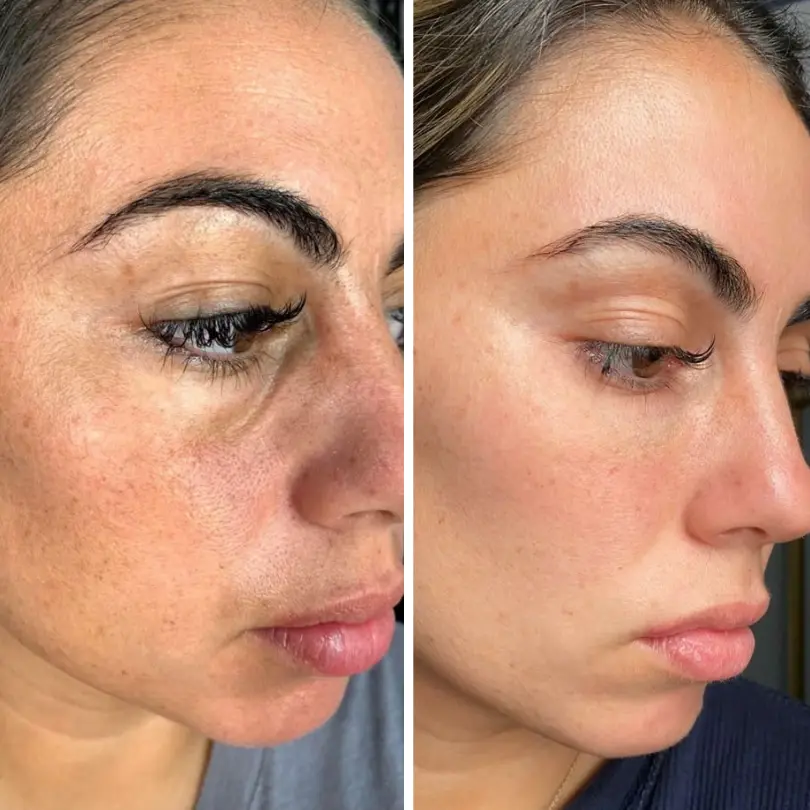 LiftRenew All-in-One Under-Eye Stick - Image 3