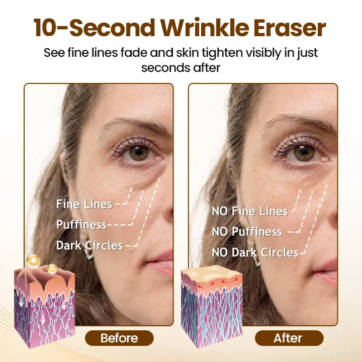 Liftora 10s Wrinkle Serum - Image 2