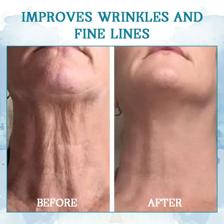 LuxeLift Skin Firming Youth Butter - Image 6