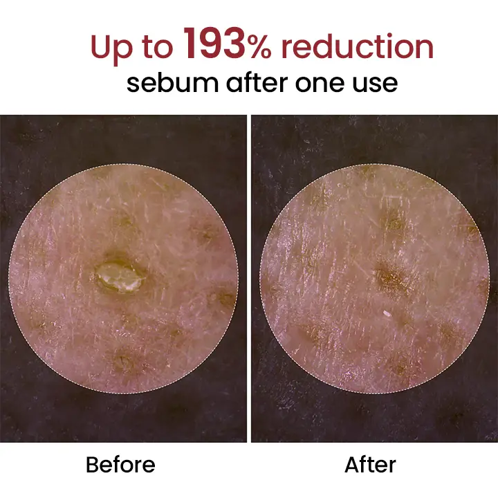 Peel Shot Glow Black Rice Ampoule - Image 5