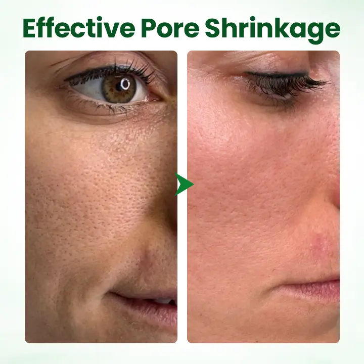 PoreMelt Avocado Acid Mask - Image 7