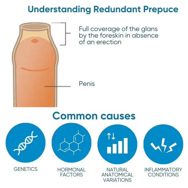 Redundant Prepuce Corrector Gel - Image 3