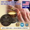CROAIE 𝐏𝐬𝐨𝐫𝐢𝐚𝐬𝐢𝐬 & 𝐄𝐜𝐳𝐞𝐦𝐚 𝐑𝐞𝐥𝐢𝐞𝐟 𝐂𝐫𝐞𝐚𝐦
