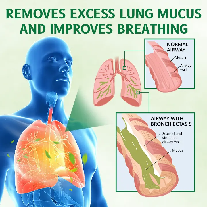 Herbal Antibacterial Lung Cleansing Nasal Spray - Image 5