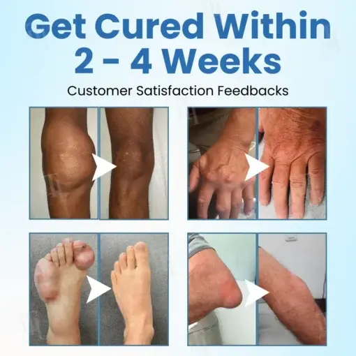 EnduraHeal Magnesium Pain Relief Cream - Image 2