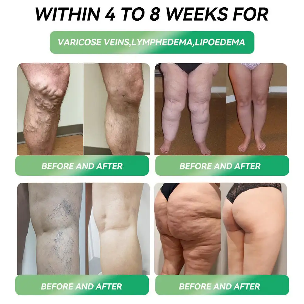 Telportide Oral Solution - Image 8