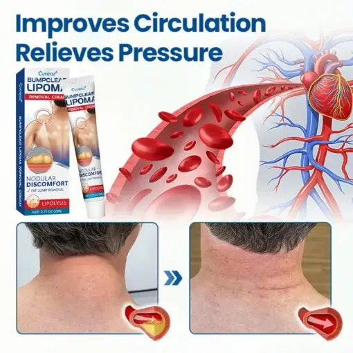 BumpClear Lipoma Removal Cream - Image 6