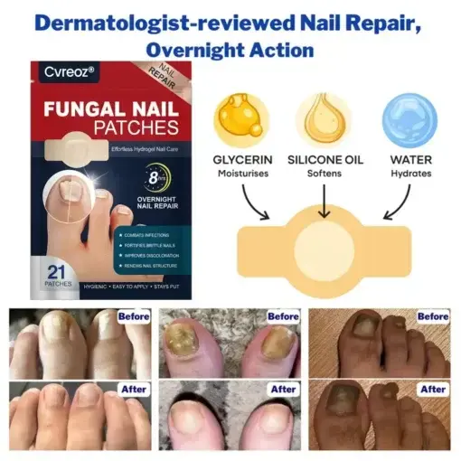 Fungal Nail Patches - Image 3