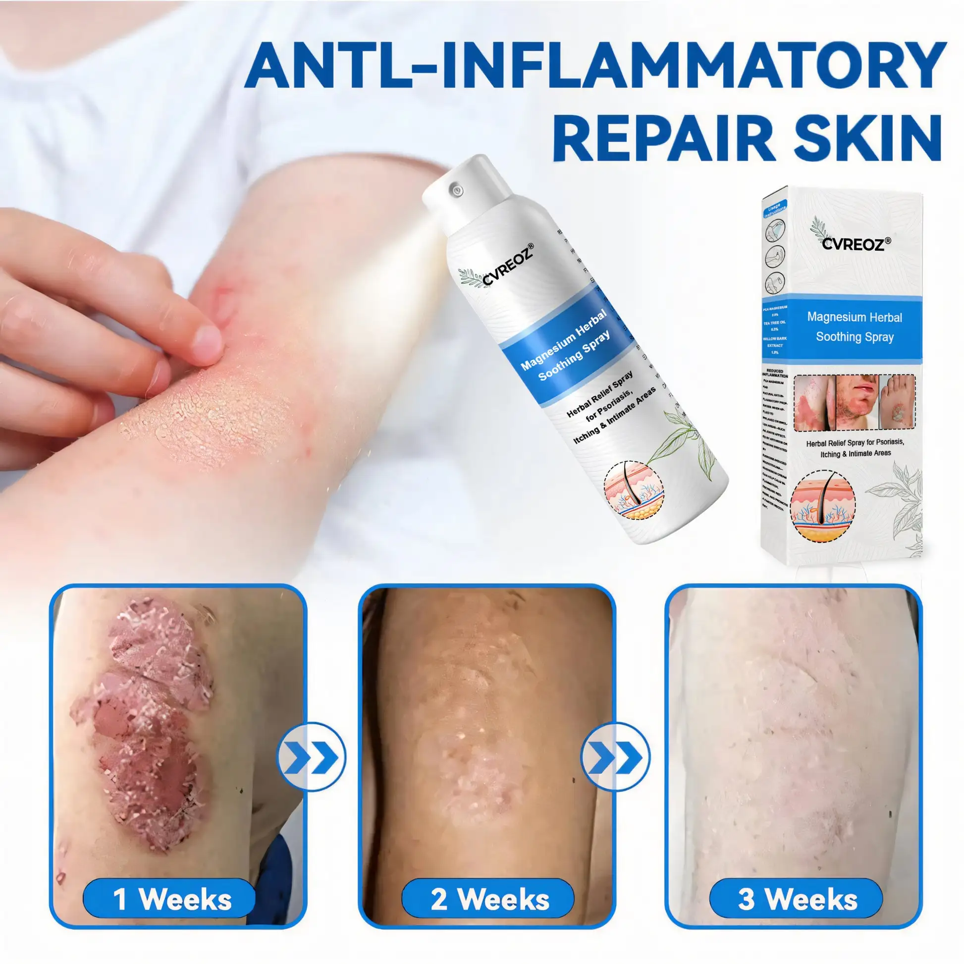 Magnesium Herbal Psoriasis Spray FDA Approved - Image 6
