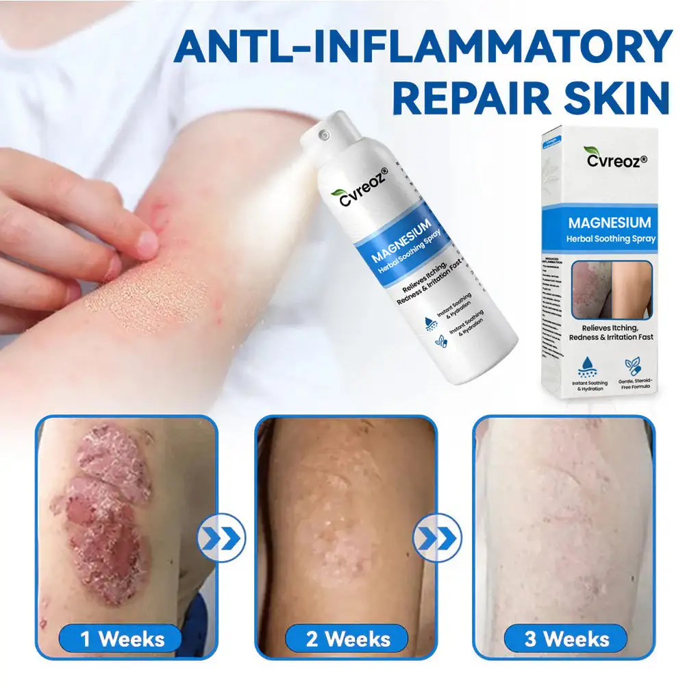 Magnesium Herbal Psoriasis Spray - Image 4