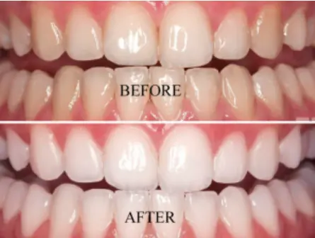 Niacinamide Intensive Whitening Toothpaste - Image 8