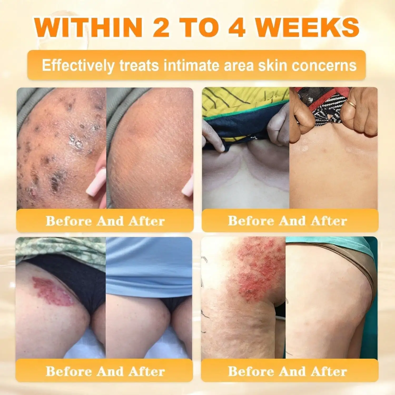 Bee Venom Skin Restoration Cream - Image 10