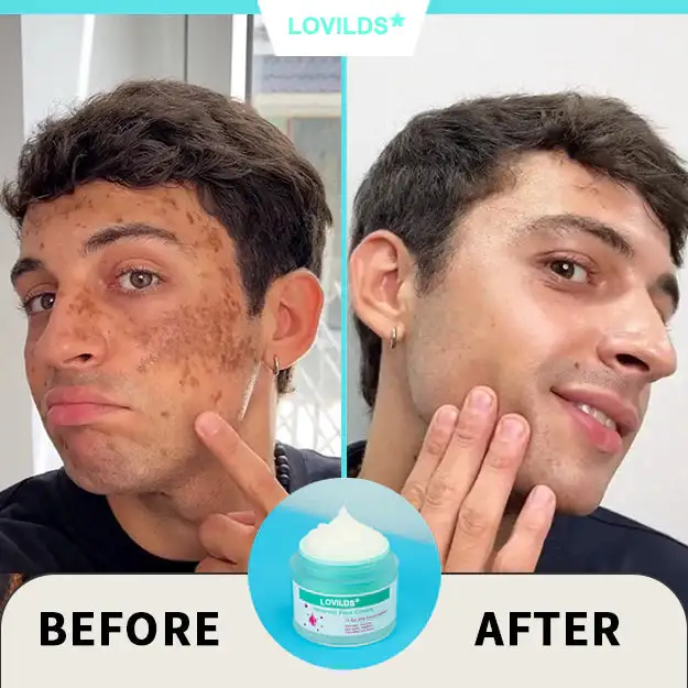 Renewal Skin Cream - Image 7