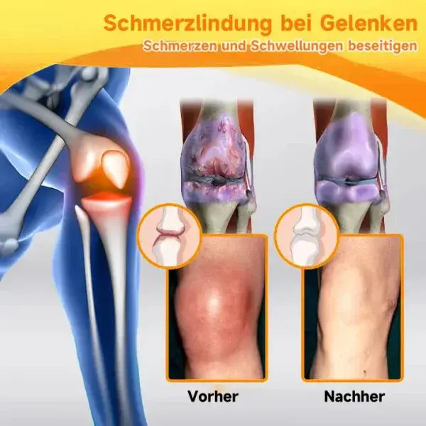 Bienengift- und Kurkuma-Gelenk- und Knochenschmerzlinderungscreme - Image 6