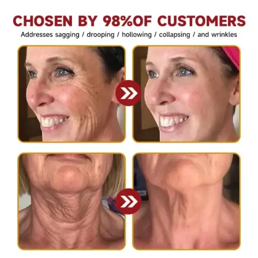 Botox Bee Venom Anti-Aging Wrinkle Serum - Image 4