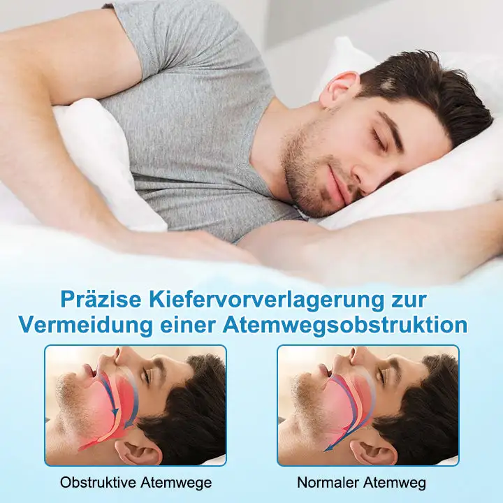 Anti-Schnarch- und Anti-Schleif-Zahnschutz - Image 7