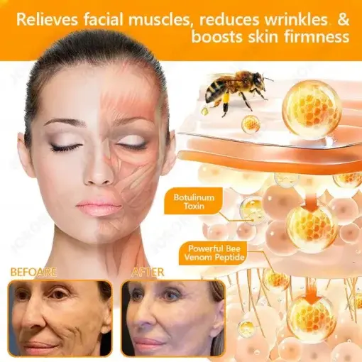 Bee Venom Senile Purpura Cream - Image 16