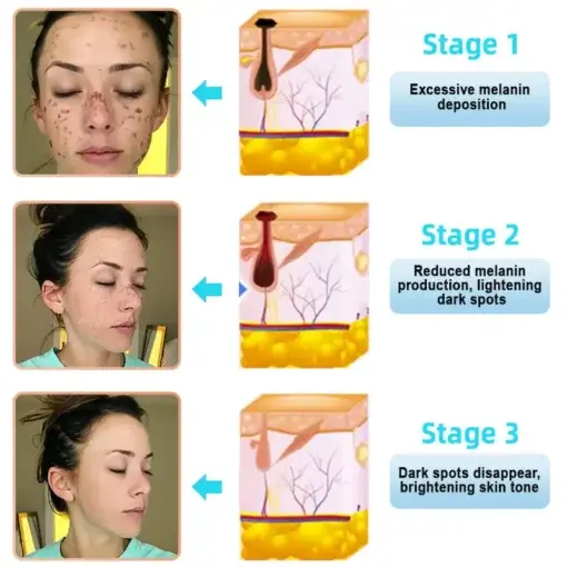 Exfoliating Cream for Dark Spots & Firmer Skin - Image 12