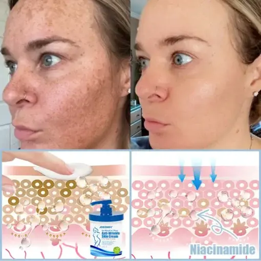 Anti-Wrinkle Skin Cream - Image 7